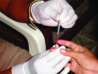 A photograph shows a person’s hand being held by a person wearing medical gloves. A thin glass tube is pressed against the persons finger and blood is moving up the tube.